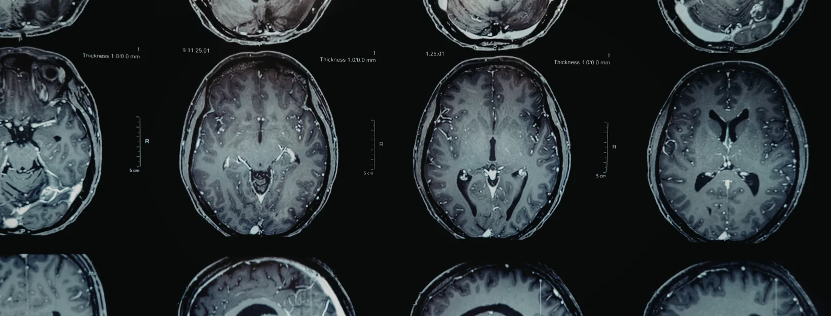 Spaced Repetition for Kids: How the Forgetting Curve Explains Spelling and Math Struggles